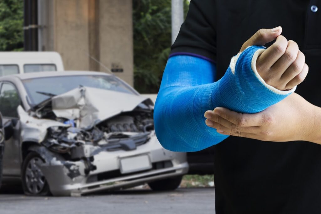 Close up view of a man with arm injury due to accident